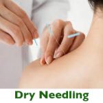 Dry Needling Health plus chiropractic Parramatta